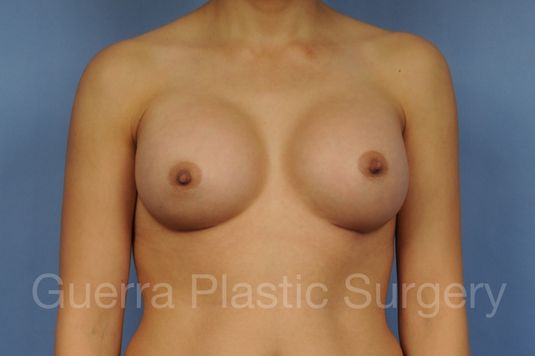 next Case #1001166 After