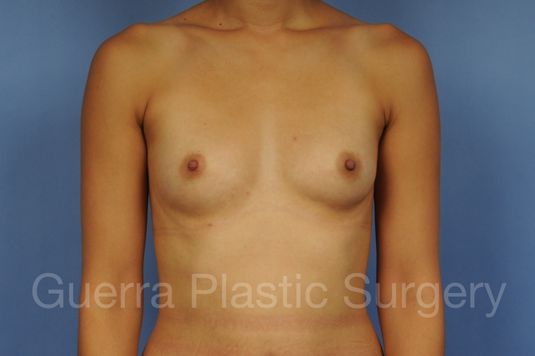 prev Case #1001168 Before