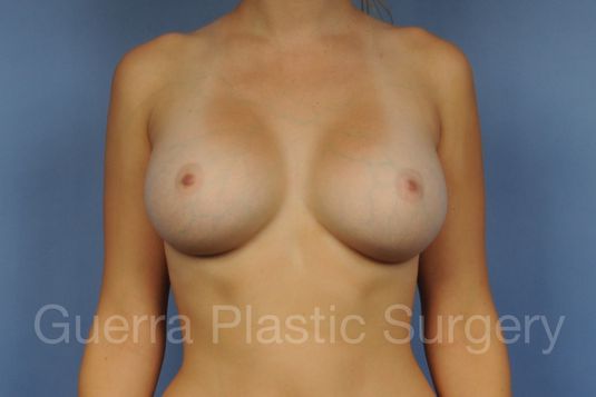 next Case #1001169 After