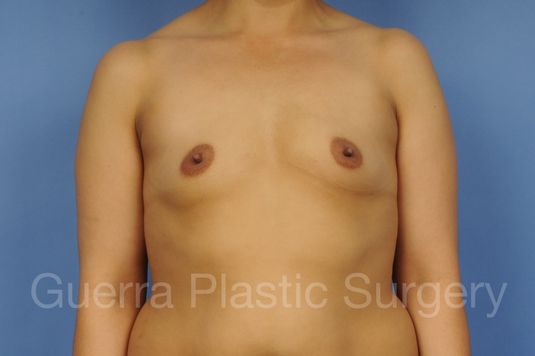 prev Case #1002050 Before