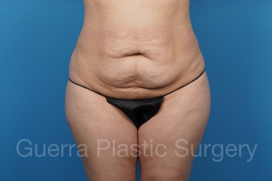 prev Case #39172 Before