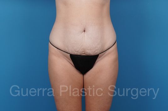 prev Case #43076 Before