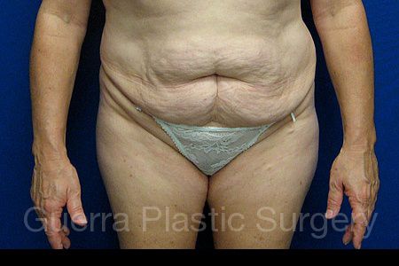 prev Case #30139 Before