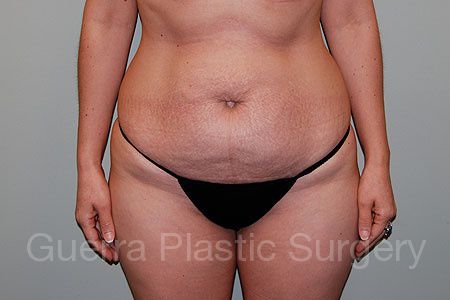 prev Case #25653 Before