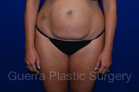 prev Case #31637 Before