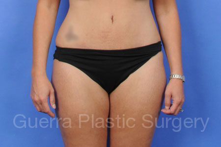 prev Case #31637 After