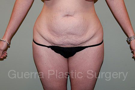 prev Case #18623 Before