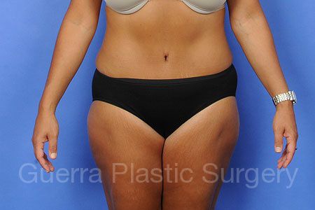 next Case #34829 After