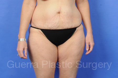 next Case #34089 Before