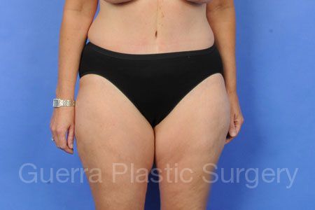 next Case #34089 After