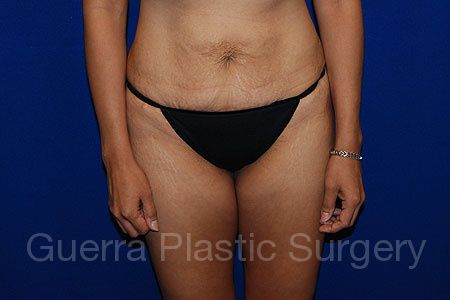 prev Case #30623 Before