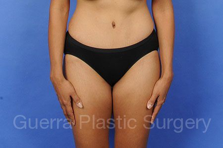 prev Case #30623 After