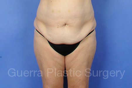 next Case #30934 Before