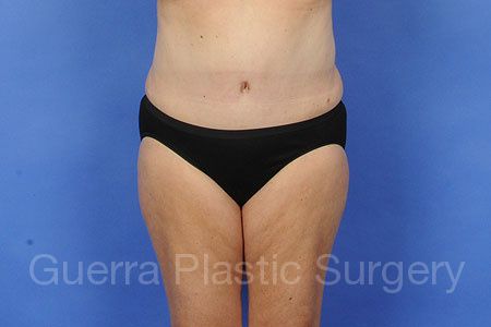 next Case #30934 After