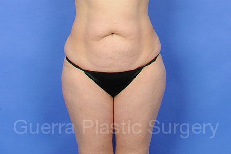 prev Case #86695 Before