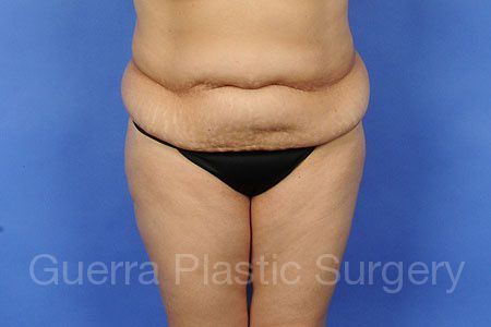 prev Case #78235 Before