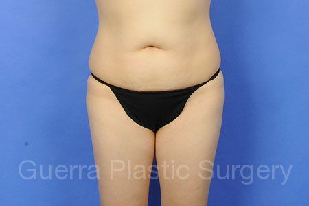 next Case #63995 Before