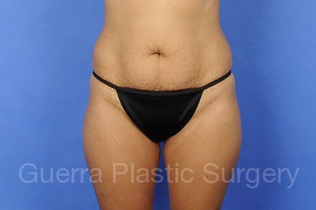 prev Case #58247 Before