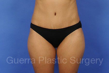 prev Case #58247 After