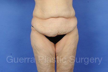 prev Case #49732 Before