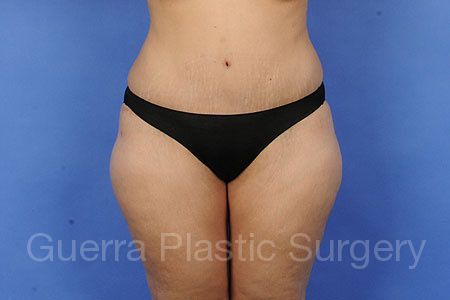 next Case #97996 After