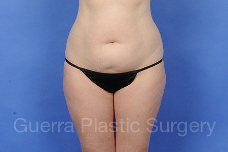 next Case #98766 Before