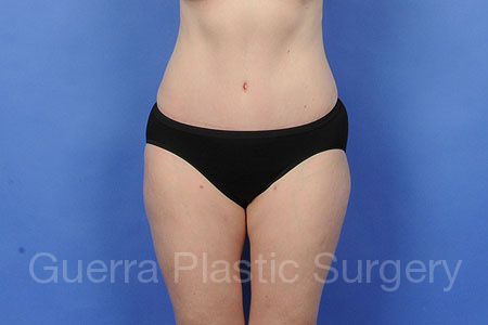 next Case #98766 After