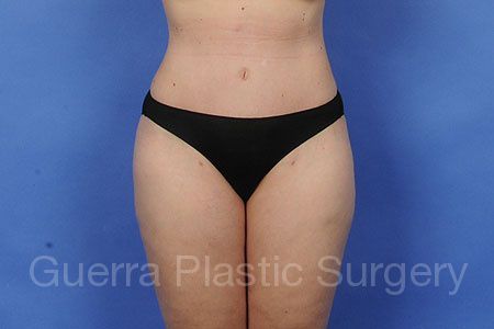 prev Case #56899 After