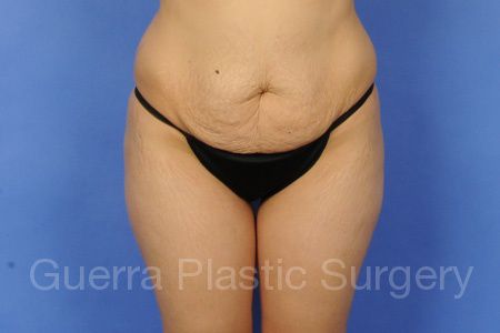 prev Case #99688 Before