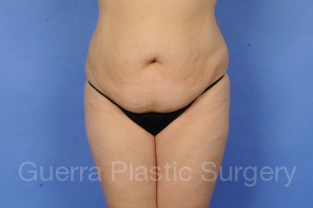 prev Case #99689 Before