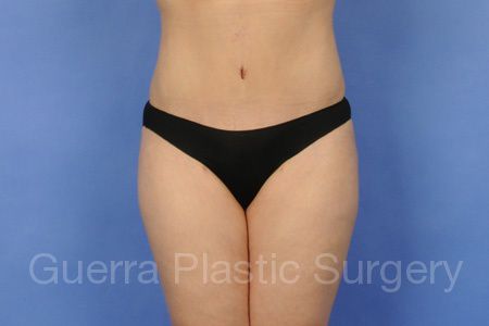 prev Case #99689 After