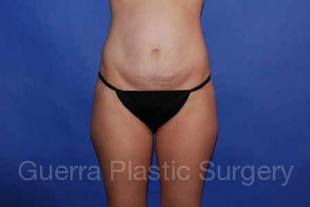 prev Case #45789 Before