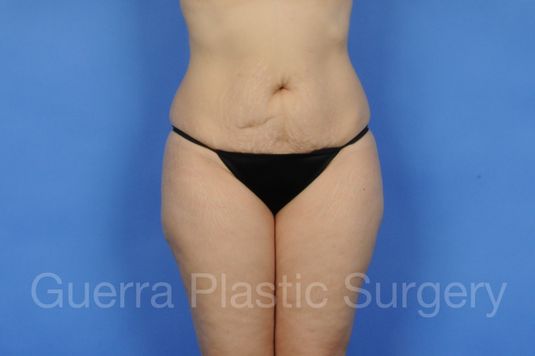 prev Case #01225 Before