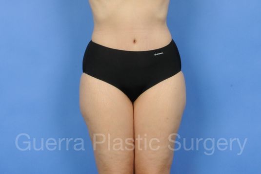 prev Case #01225 After