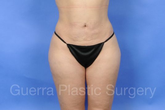 next Case #01228 Before