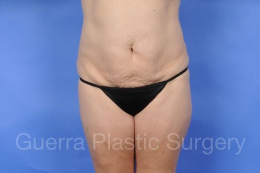 prev Case #01234 Before