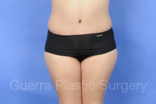 next Case #01238 After