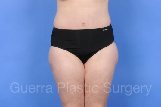 prev Case #01253 After