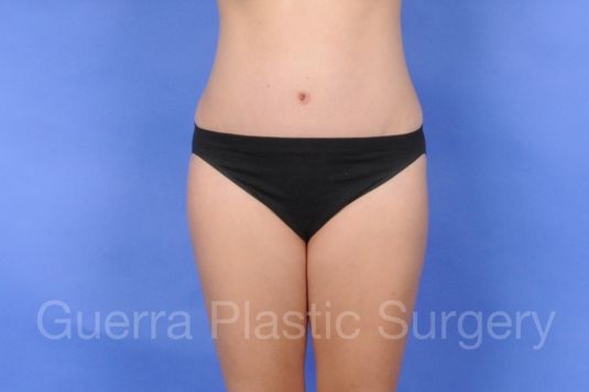 next Case #01261 After