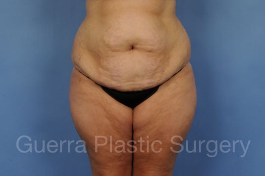 prev Case #01269 Before