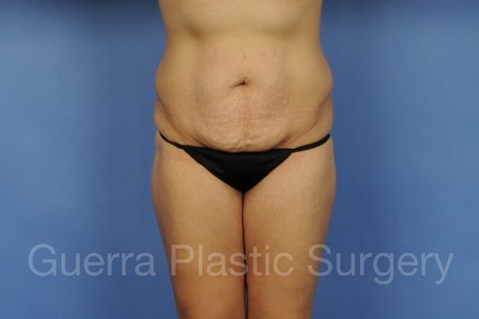 prev Case #01280 Before