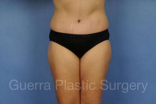 prev Case #01280 After