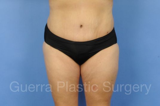 next Case #01294 After