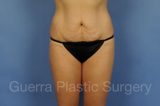 prev Case #01295 Before