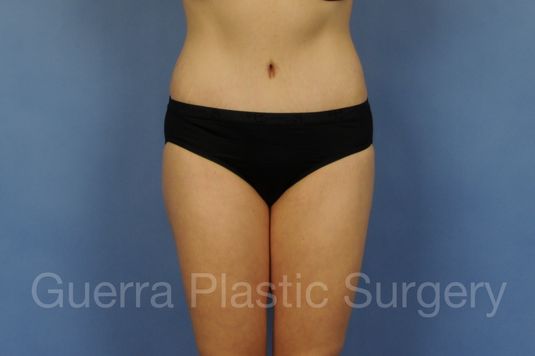 prev Case #01295 After