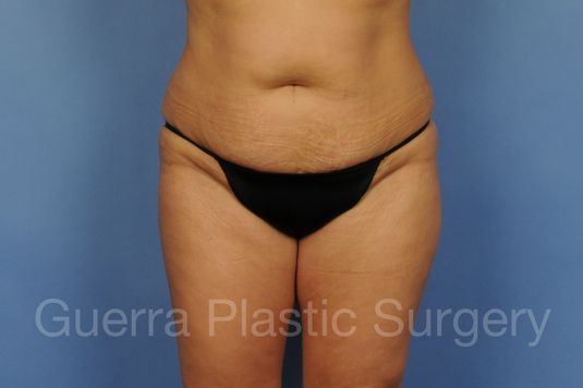 next Case #01296 Before