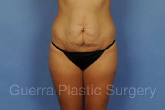 prev Case #01300 Before