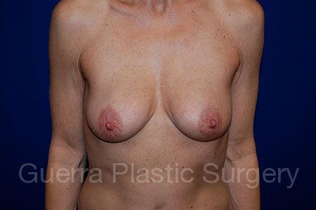 next Case #28433 Before