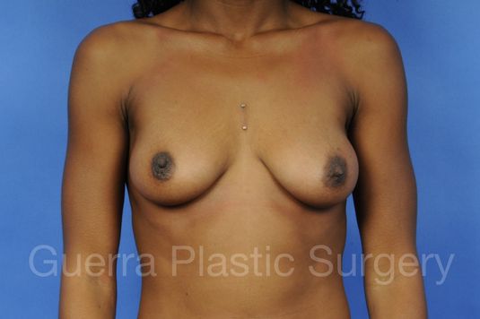 prev Case #1109011 Before