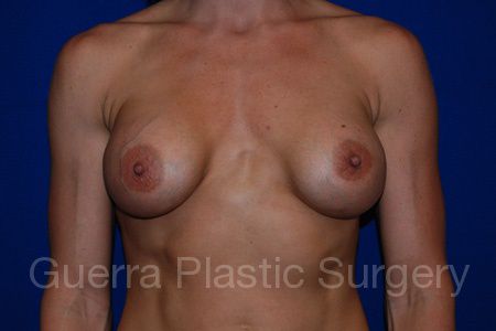 next Case #30943 Before